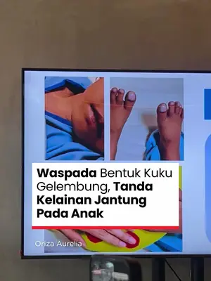 Thumbnail TikTok