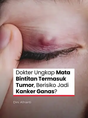 Thumbnail TikTok