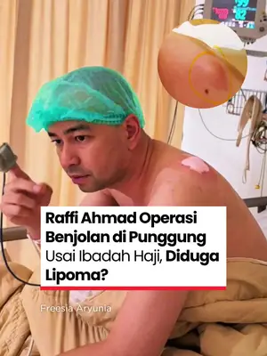 Thumbnail TikTok