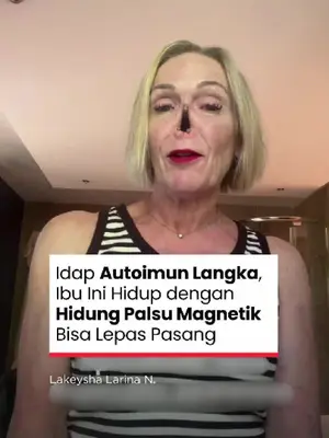 Thumbnail TikTok