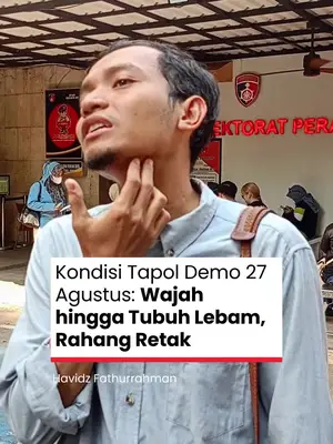 Thumbnail TikTok